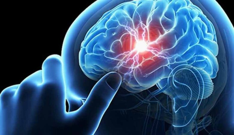 لیست بهترین متخصص سکته مغزی شیراز