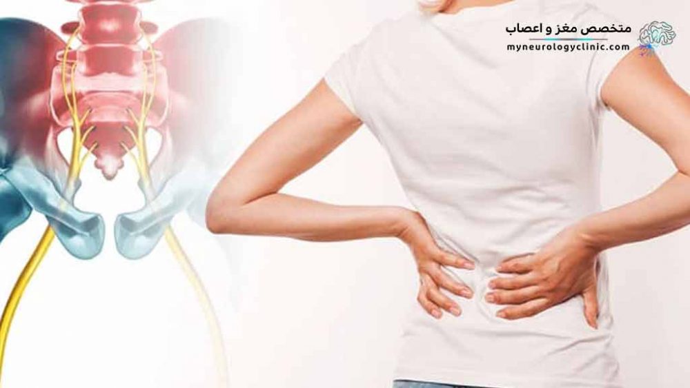 درد سیاتیک چیست؟