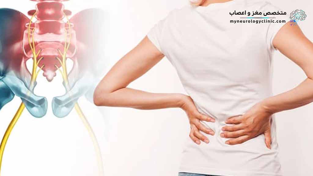 درد سیاتیک چیست؟
