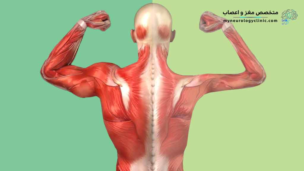 علائم بیماری میوپاتی چیست؟